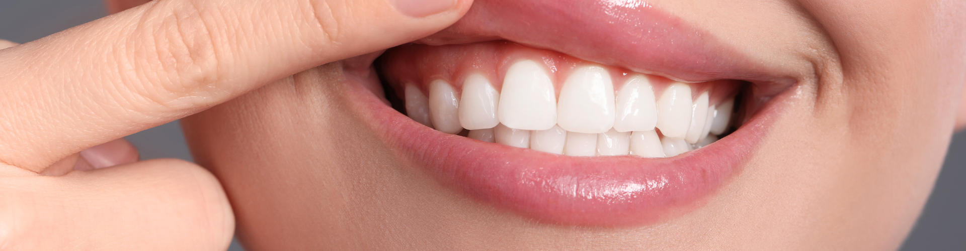 Woman lifting her top lip to show gums.